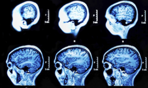 Images of brain scans